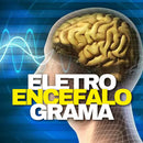 (EEG) Eletroencefalograma - RESERVA HORÁRIO